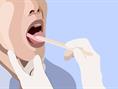 کمک به درمان سرطان زبان با شربت سیکلوتاید